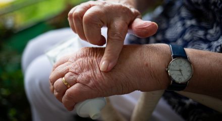 rheumatoid arthritis negligence