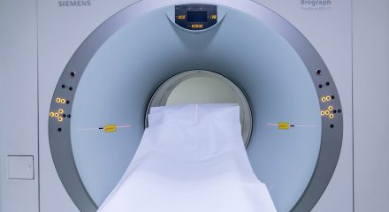 MRI scan negligence